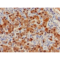 Arginase 1 (ARG1) Antibody