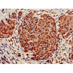 Stomatin-Like Protein 3 (STOML3) Antibody