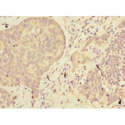 Abhydrolase Domain Containing 2 (ABHD2) Antibody