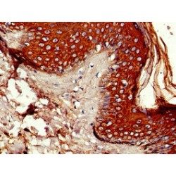 Prolyl 4-Hydroxylase Subunit Alpha-1 (P4HA1) Antibody