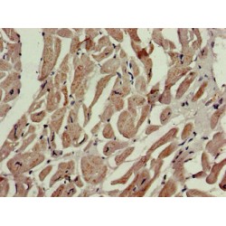 Prolyl 4-Hydroxylase Subunit Alpha-1 (P4HA1) Antibody