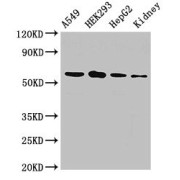 WB analysis of A549 whole cell lysates, HEK293 whole cell lysates, HepG2 whole cell lysates, and Rat Kidney tissue, using P4HA1 antibody (2.5 µg/ml) and Goat anti-Rabbit IgG (1/50000).