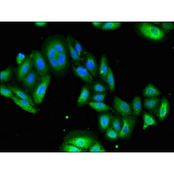 Ubiquitin Carboxyl-Terminal Hydrolase 6 (USP6) Antibody