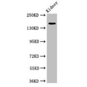 WB analysis of Rat Kidney tissue, using USP6 antibody (4 µg/ml). Predicted band size: 159, 122, 90 kDa. Observed band size: 159 kDa.