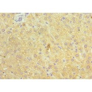 IHC-P analysis of human liver tissue, using ATP7B antibody (1/100 dilution).