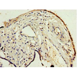 ADAM Metallopeptidase Domain 33 (ADAM33) Antibody