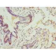 IHC-P analysis of human lung tissue, using ABCA3 Antibody (1/100 dilution).