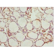 IHC-P analysis of paraffin embedded Human thyroid tissue using PRPH antibody (1/100 dilution).