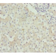 IHC-P analysis of human liver tissue, using WDR45 antibody (1/100 dilution).