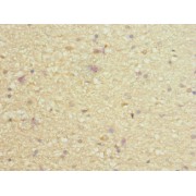 IHC-P analysis of Human brain tissue, using PIEZO1 antibody (1/100 dilution).
