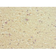 IHC analysis of paraffin-embedded human brain tissue, using PIEZO1 antibody (1/100 dilution).