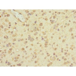 Piezo-Type Mechanosensitive Ion Channel Component 1 (PIEZO1) Antibody