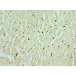 Muscarinic Acetylcholine Receptor M3 (CHRM3) Antibody