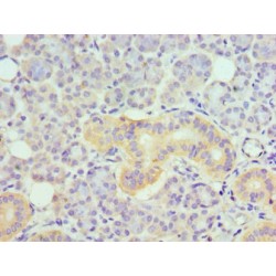 Tumor Necrosis Factor Receptor Superfamily, Member 21 (TNFRSF21) Antibody