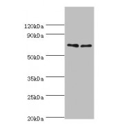 WB analysis of (1) K562, and (2) Jurkat whole cell lysates, using TNFRSF21 antibody (4 µg/ml) and goat anti-rabbit IgG secondary antibody (1/10000 dilution). Predicted band size: 72 kDa, Observed band size: 72 kDa.