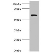 WB analysis of HepG2 whole cell lysates, using GAD1 Antibody (8 µg/ml). Predicted band size: 64, 26, 48 kDa, observed band size: 67 kDa.