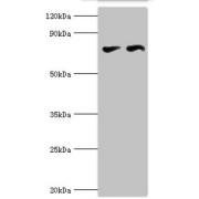 WB analysis of (1) PC-3, and (2) MCF-7 whole cell lysates, using CTCF antibody (6 µg/ml). Predicted band size: 83, 46 kDa, Observed band size: 83 kDa.