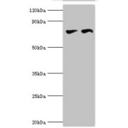 WB analysis of (1) PC-3, and (2) MCF-7 whole cell lysates, using CTCF antibody (6 µg/ml). Predicted band size: 83, 46 kDa, Observed band size: 83 kDa.