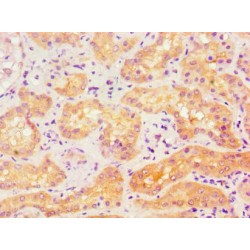 Activin Receptor Type-1 (ACVR1) Antibody