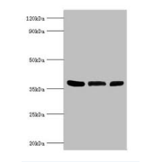 Arginase 2 (ARG2) Antibody