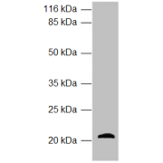 WB analysis of mouse placenta tissue, using APOM antibody (3.93 µg/ml). Predicted band size: 22 kDa, 14 kDa. Observed band size: 22 kDa.