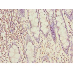 SPT20 Homolog, SAGA Complex Component (SUPT20H) Antibody