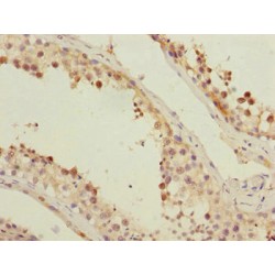 SPT20 Homolog, SAGA Complex Component (SUPT20H) Antibody