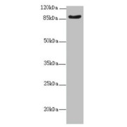 Western blot analysis of Mouse kidney tissue using SUPT20H antibody (2.07 µg/ml). Predicted band sizes: 86 kDa, 81 kDa, 89 kDa; Observed band size: 86 kDa.