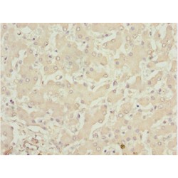 LIM/Homeobox Protein Lhx6 (LHX6) Antibody