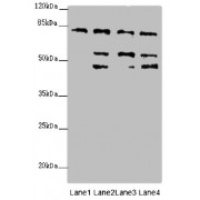 Western blot analysis of (1) HeLa whole cell lysates, (2) 293T whole cell lysates, (3) Mouse liver tissue, and (4) Mouse kidney tissue, using ZFYVE1 antibody (6.89 µg/ml) as the primary antibody and Goat anti-Rabbit polyclonal IgG (1/10000 dilution) as the secondary antibody.