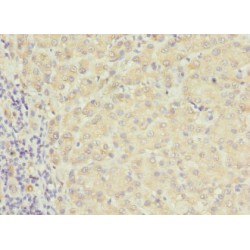 Ras-Related Protein Rab-17 (RAB17) Antibody