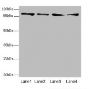 Western blot analysis of (1) HeLa whole cell lysate, (2) Mouse heart tissue, (3) HepG-2 whole cell lysate and (4) Jurkat whole cell lysate, using TNNI3K antibody (4.77 µg/ml) and goat polyclonal anti-rabbit IgG (1/10000 dilution).