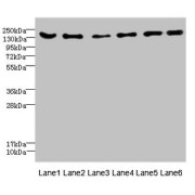 WB analysis of (1) mouse brain tissue, (2) mouse lung tissue, (3) 293T whole cell lysates, (4) HepG2 whole cell lysates, (5) Jurkat whole cell lysates, and (6) HeLa whole cell lysates, using GPR126 antibody (4.61 µg/ml). Predicted band size: 137, 134, 140 kDa. Observed band size: 137 kDa.