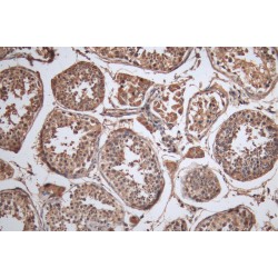 Protein Cereblon (CRBN) Antibody