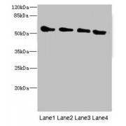 WB analysis of (1) Rat Heart tissue, (2) Mouse Kidney tissue, (3) 293T whole cell lysates, and (4) HepG2 whole cell lysates, using TRHDE antibody (1.77 µg/ml). Predicted band size: 117 kDa. Observed band size: 117 kDa.