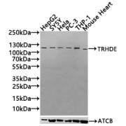WB analysis of various whole cell and tissue lysates (30 µg/lane), using TRHDE antibody (1/1000 dilution). Calculated MW: 117, 123 kDa. Observed MW: 117 kDa, Exposure time: 120 seconds.
