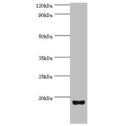 WB analysis of rat brain tissue, using UTS2 antibody (8 µg/ml). Predicted band size: 15 kDa and 17 kDa; Observed band size: 15 kDa.