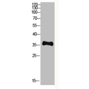 WB analysis of KB cells, using Pan myristoylation Antibody (1/500 dilution).
