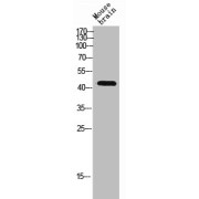 WB analysis of Mouse brain cell lysate, using Blood Group RhD Polypeptide (RHD) Antibody.