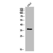 WB analysis of COLO cells, using Immunoglobulin Heavy Constant Gamma 1 (IGHG1) antibody.