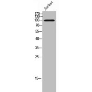 WB analysis of Jurkat cells using Cadherin-17 (CDH17) Antibody.