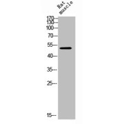 Western blot analysis of rat muscle cell extracts using Glial Fibrillary Acidic Protein Antibody.
