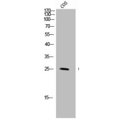 Free Fatty Acid Receptor 1 (FFAR1) Antibody