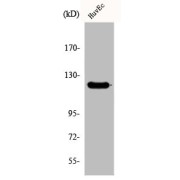 WB analysis of HuvEc cells.