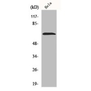 Western blot analysis of HeLa cells, using NEIL3 antibody.