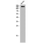 WB analysis of HuvEc cells, using CEP152 antibody.