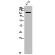 WB analysis of K562 cells.