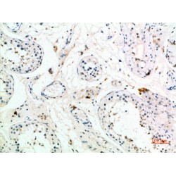 Pro-MCH (PMCH) Antibody