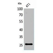abx327533