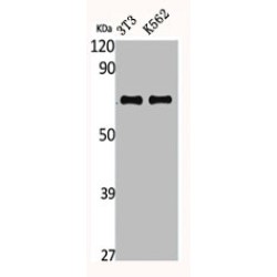 CTP Synthase 1 (CTPS1) Antibody